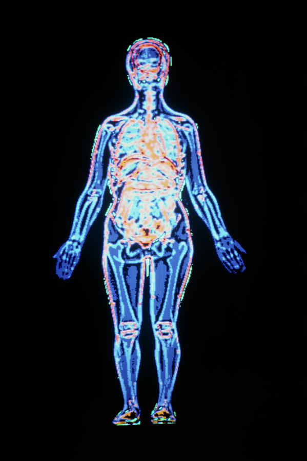 Coloured Ct Scan Showing Human Photograph by Gca/science Photo Library
