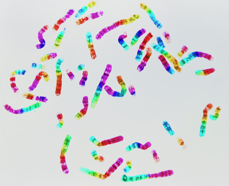 Images Photograph - Coloured Lm Of A Normal Male Karyotype by L. Willatt, East Anglian Regional Genetics Service/science Photo Library