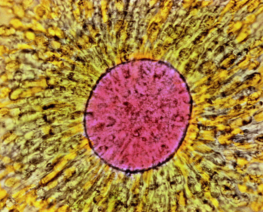 Coloured Lm Of Mature Human Oocyte Photograph by Professor P.m. Motta Et Al/science Photo Library
