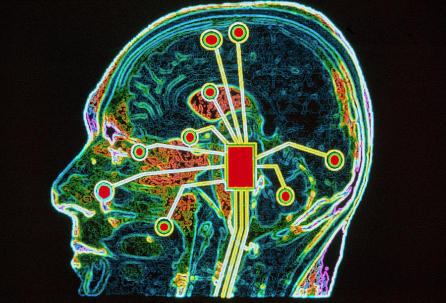 Coloured Mri Brain Scan With Sensory Map Photograph by Gca/science Photo Library