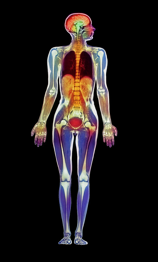 Coloured Mri Scan Of A Whole Human Body F Photograph by Simon Fraser/science Photo Library