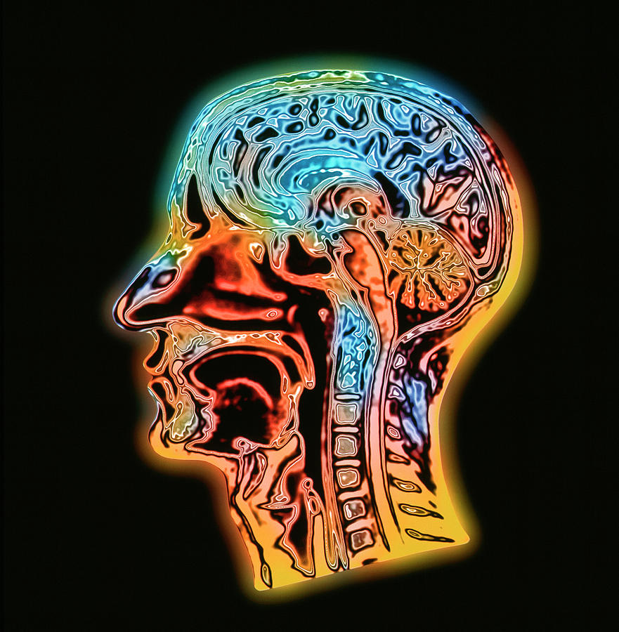 Coloured Mri Scan Of The Human Head (side View) Photograph by Alfred Pasieka/science Photo Library