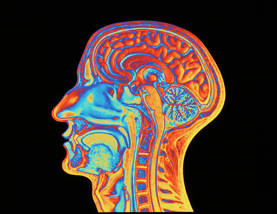 Coloured Mri Scan Of The Human Head (side View) Photograph by Pasieka