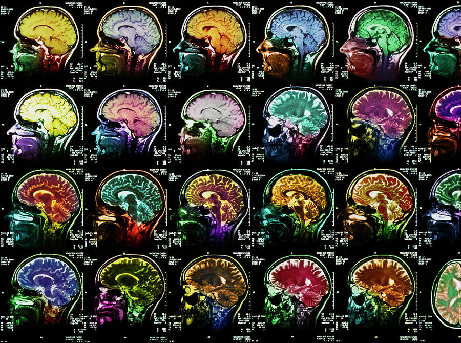 Coloured Sagittal Mri Scans Of The Human Brain Photograph by Simon Fraser/science Photo Library