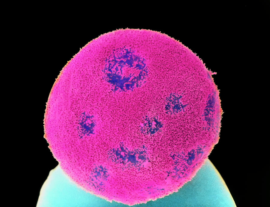 Coloured Sem Of A Blastocyst Embryo 6 Days Old Photograph by Science Photo Library Coloured Sem Of A Blastocyst Embryo 6 Days Old Photograph by Science Photo Library