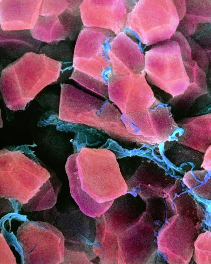 Coloured Sem Of A Blood Clot Photograph by Prof. P. Motta/dept. Of ...