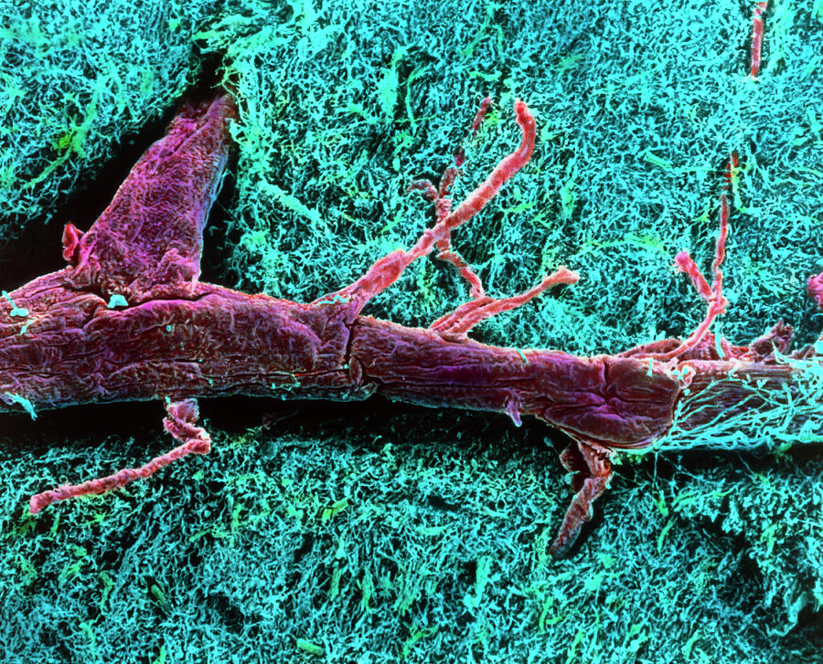 Coloured Sem Of A Blood Vessel In The Spinal Cord Photograph by Steve Gschmeissner/science Photo Library