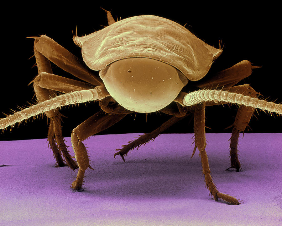 Coloured Sem Of A Cockroach Photograph by Science Pictures Limited/science Photo Library