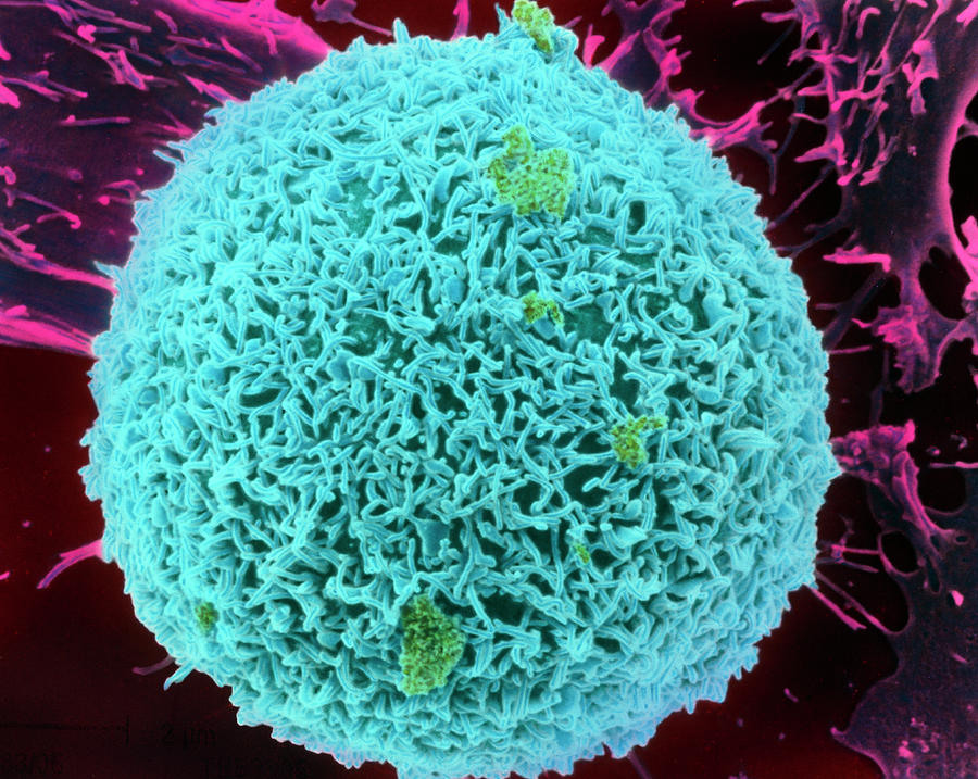 Coloured Sem Of A Liver Cell (hepatocyte) Photograph by A. Dowsett, Health Protection Agency/science Photo Library