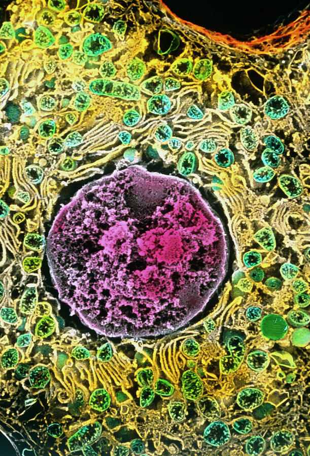 Coloured Sem Of A Liver Cell (hepatocyte) Photograph By Professors P 