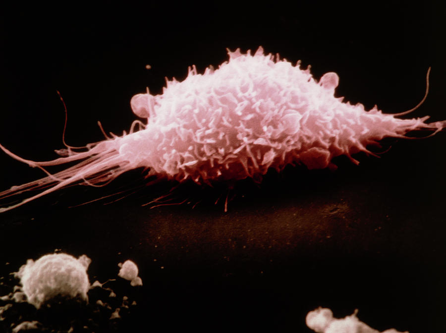 Coloured Sem Of A Macrophage Cell In Movement Photograph By Nibsc 