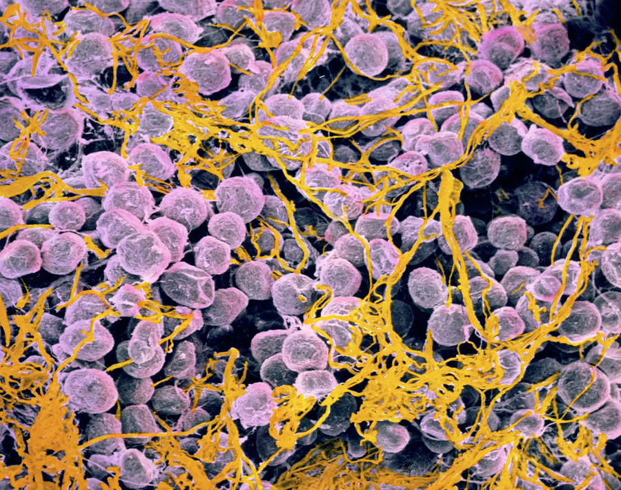 Coloured Sem Of Adipose Tissue Showing Fat Cells Photograph by Prof. P. Motta/dept. Of Anatomy/university \la Sapienza\, Rome/science Photo Library