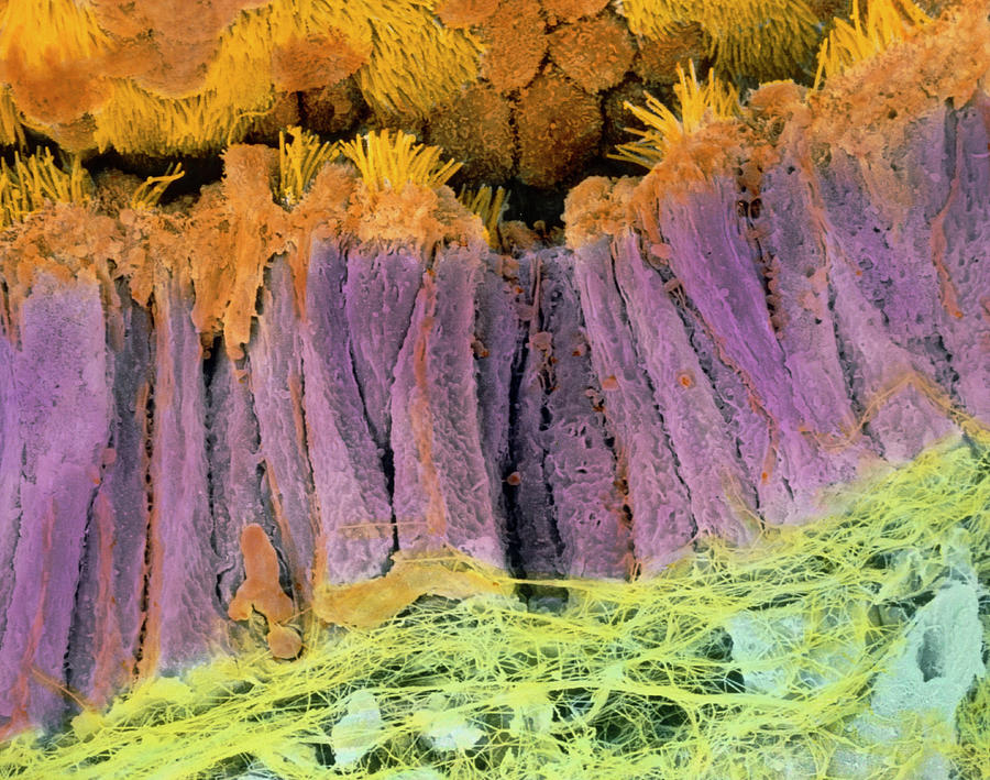 Coloured Sem Of Epithelium In The Fallopian Tube Photograph by ...