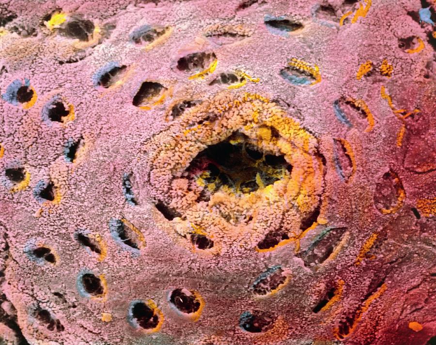 Coloured Sem Of Glandular Surface Of Human Colon Photograph by Professors P.m. Motta & F.m. Magliocca/ Science Photo Library