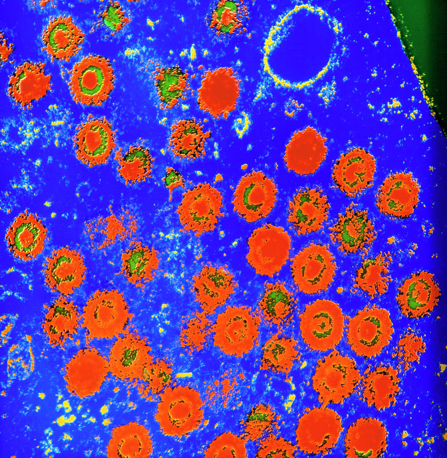 Coloured Sem Of Herpes Simplex Virus Photograph by A.b. Dowsett/science Photo Library