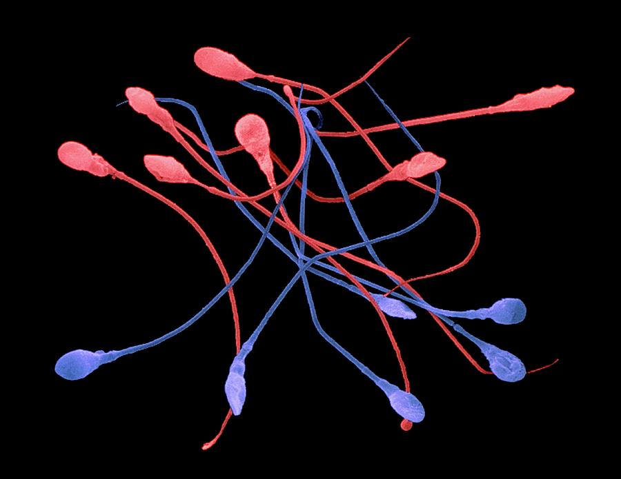 Coloured Sem Of Human Sperm: Male & Female Types Photograph by Dr Tony Brain/science Photo Library