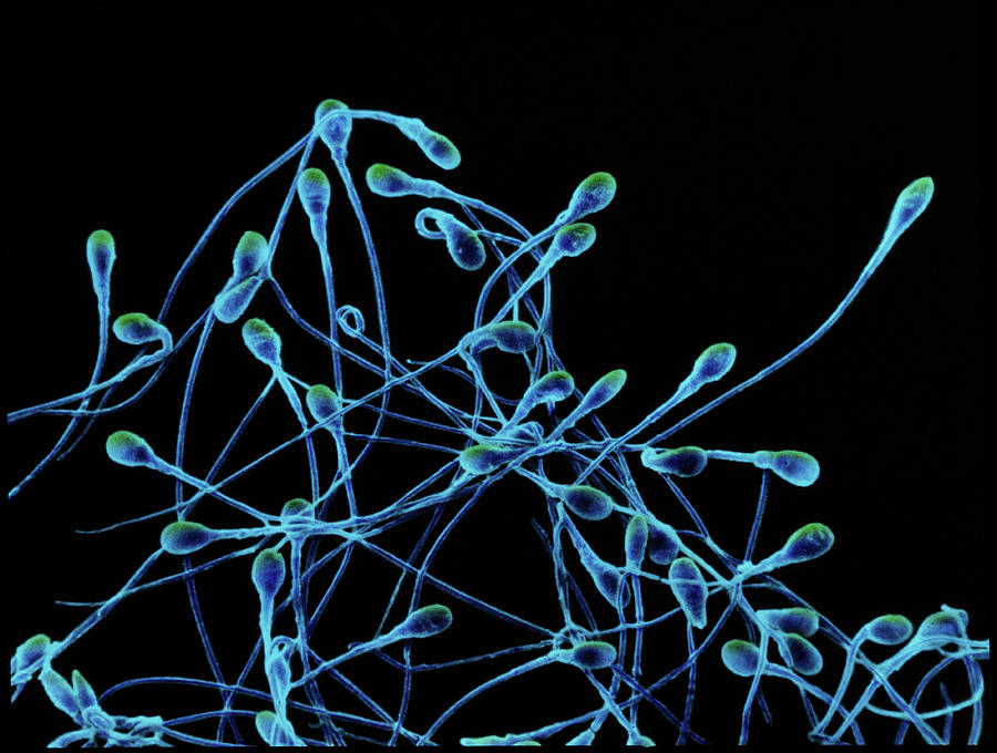 Coloured Sem Of Human Spermatozoa Photograph by Dr Yorgos Nikas/science Photo Library