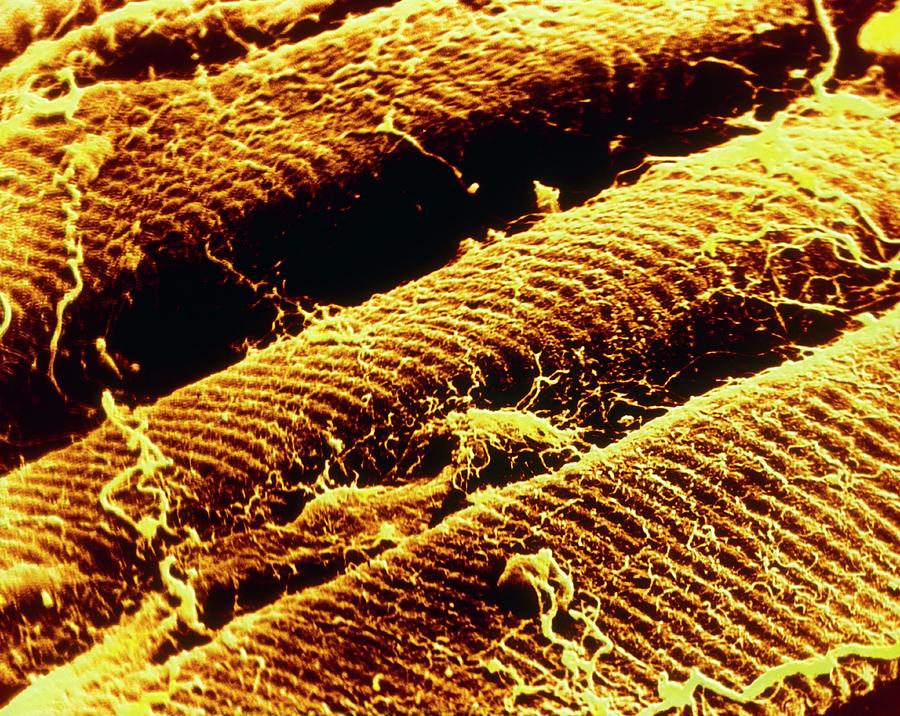 Striated Muscle Photograph - Coloured Sem Of Human Striated Muscle by Cnri/science Photo Library
