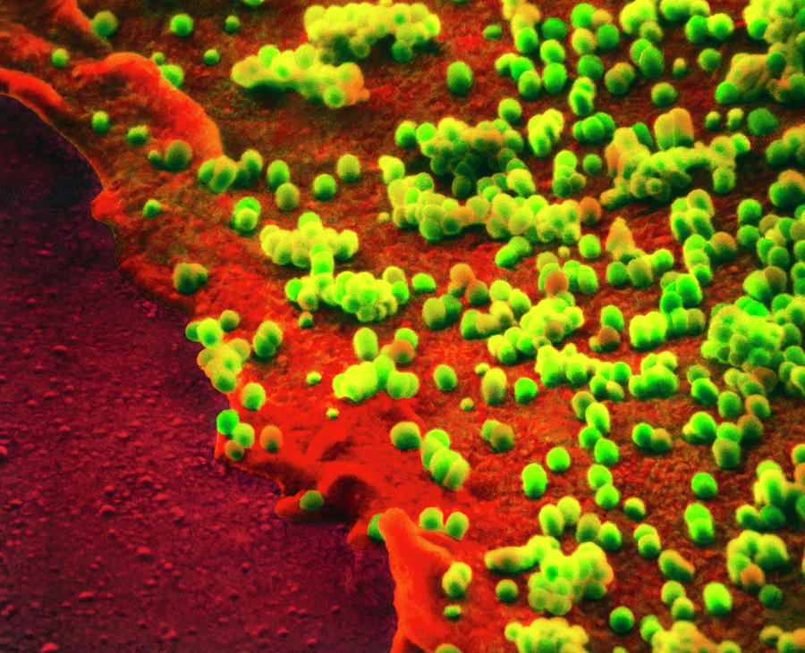Coloured Sem Of Influenza Virus On Cell Surface Photograph by Nibsc/science Photo Library
