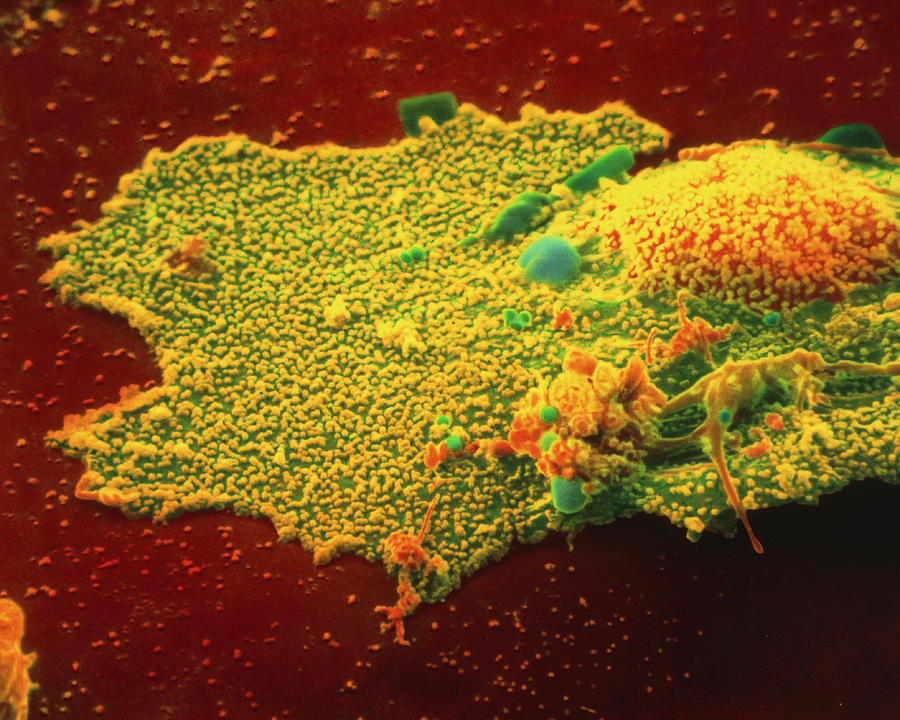 Coloured Sem Of Influenza Viruses Infecting Cell Photograph by Nibsc/science Photo Library