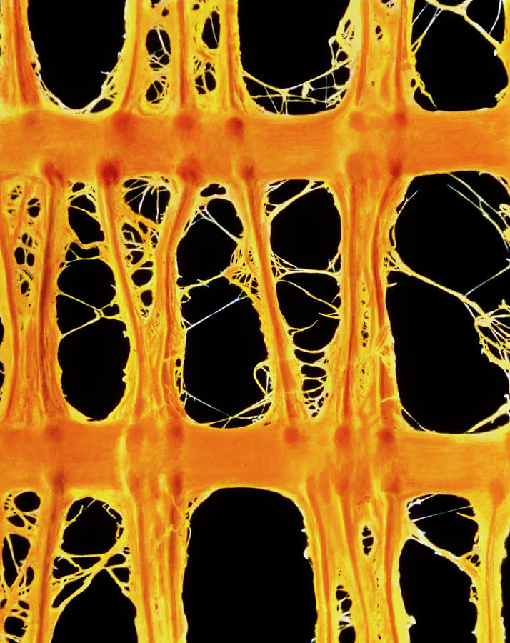 Coloured Sem Of Polypropylene Netting by Science Photo Library