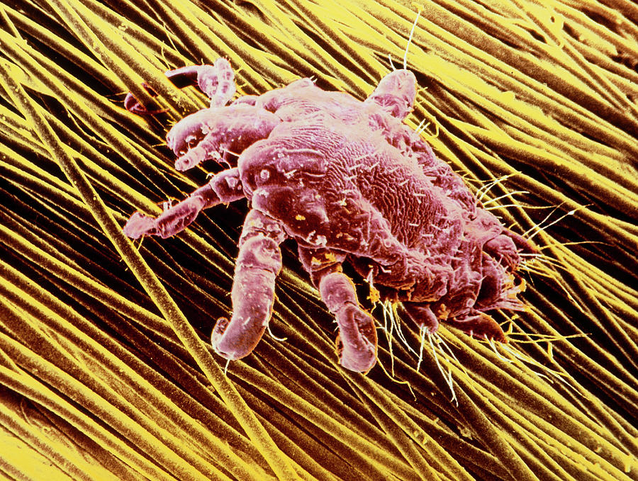 Coloured Sem Of Pubic Louse On Pubic Hair Photograph By E Grayscience 