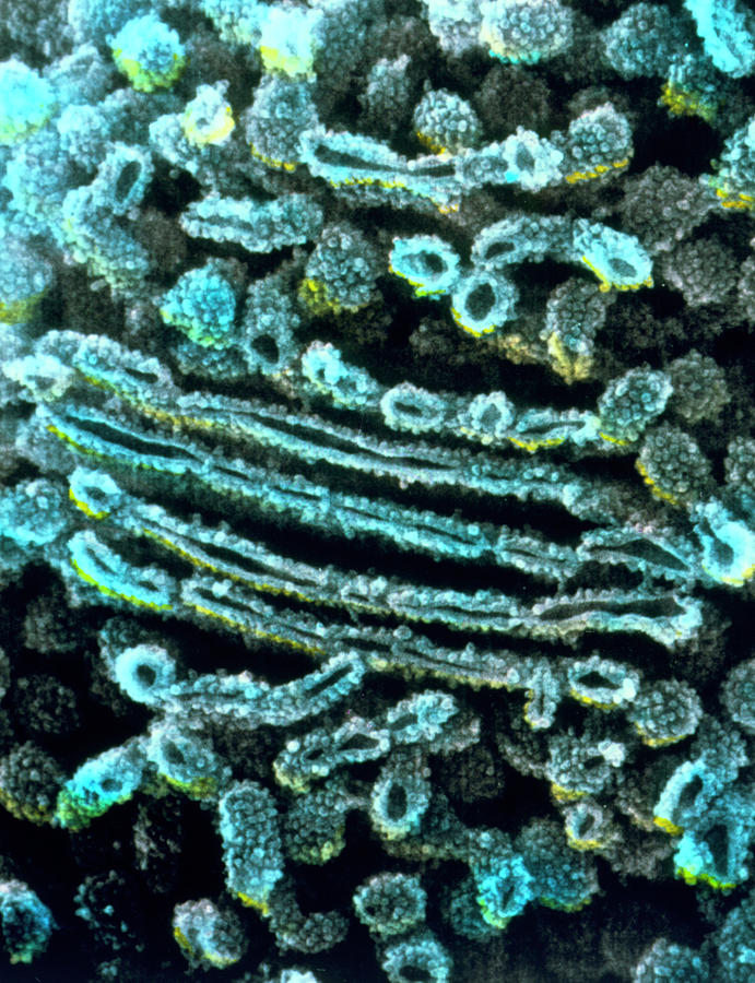 Coloured Sem Of Rough Endoplasmic Reticulum Photograph by Professors P. Motta & T. Naguro/science Photo Library