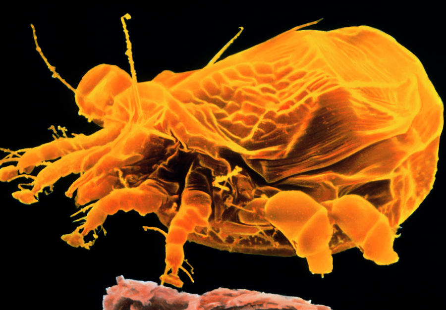 Wildlife Photograph - Coloured Sem Of Sarcoptes Sp by Cath Wadforth/science Photo Library