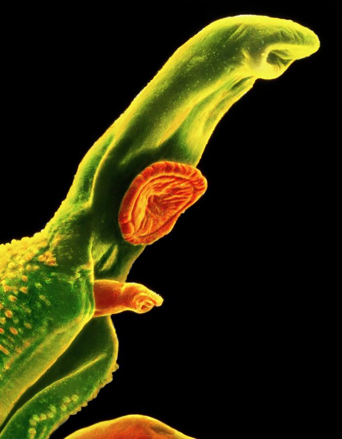 Coloured Sem Of Schistosoma (bilharzia) Fluke Photograph by National Cancer Institute/science Photo Library