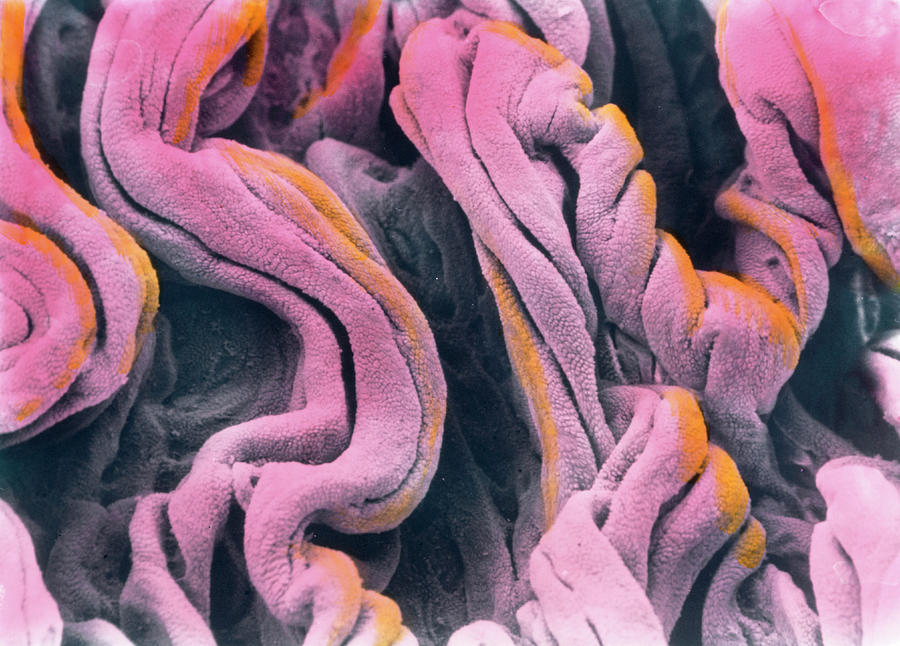 coloured-sem-of-surface-of-vaginal-epithelium-prof-p-mottadept-of-anatomyuniversity-la-sapienza-romescience-photo-library.jpg