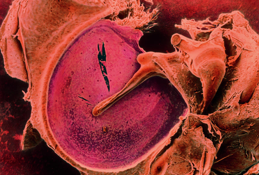 Coloured Sem Of The Eardrum And Associated Bones Photograph by Steve ...