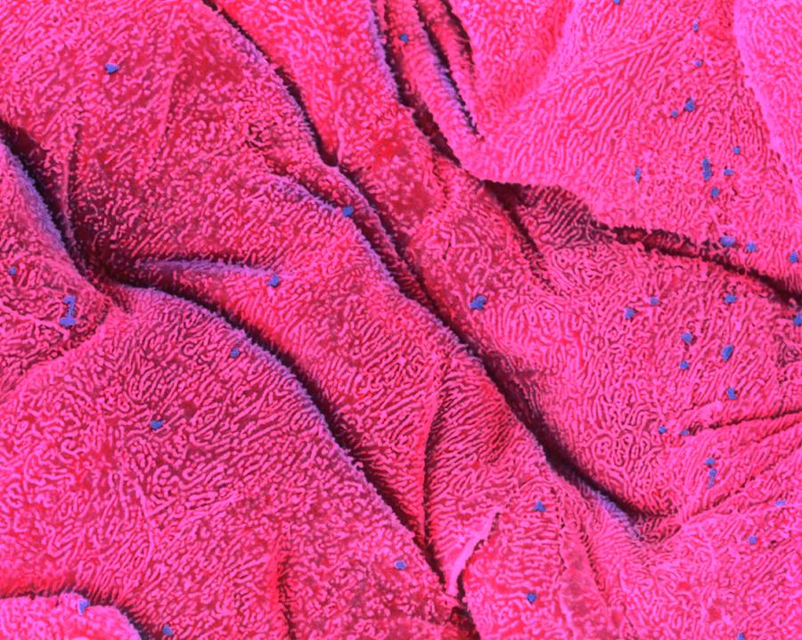 Coloured Sem Of The Surface Of The Tongue Photograph by Steve Gschmeissner/science Photo Library