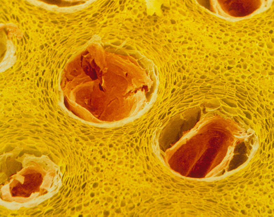 Nature Photograph - Coloured Sem Of Trichomes In Lemon Peel. by Power And Syred