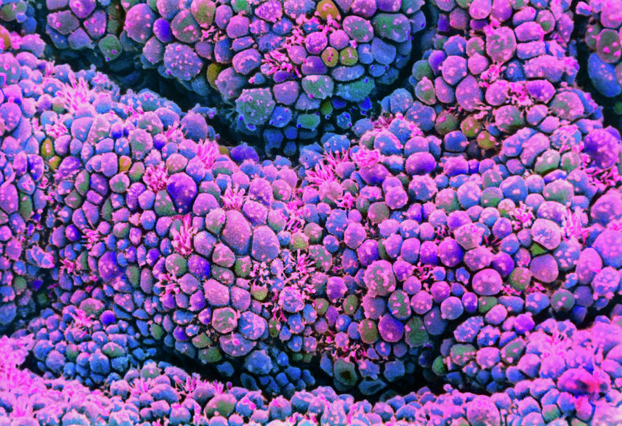 Coloured Sem Of Uterus Lining (receptive Stage) Photograph by Dr Yorgos ...