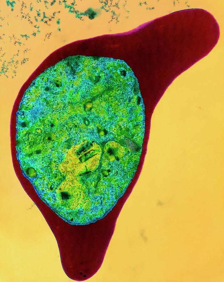 Coloured Tem Of A Blood Cell With Malaria Photograph by Dr Tony Brain ...