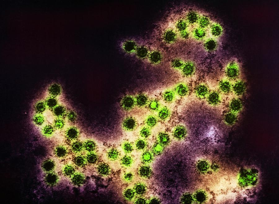 Coxsackie Virus Photograph - Coloured Tem Of A Group Of Coxsackie Viruses by Cdc/science Photo Library
