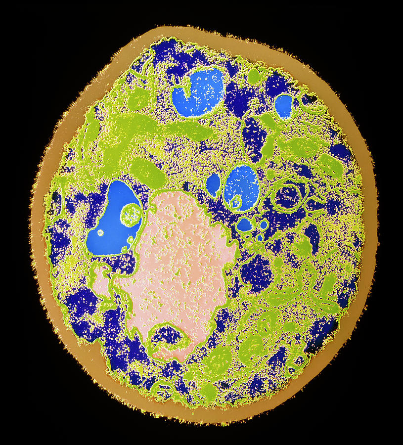 Coloured Tem Of A Yeast Cell Photograph by A.b. Dowsett/science Photo ...