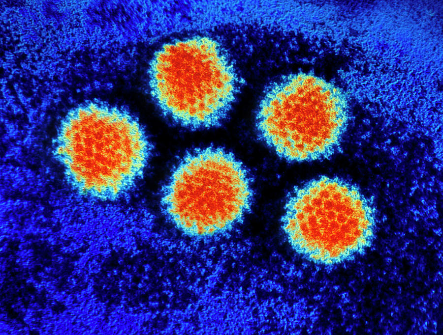 Coloured Tem Of Adenoviruses Photograph by Bonnie Cosgrove/science Photo Library
