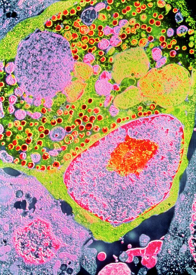 Coloured Tem Of Chlamydia Sp. Bacteria Photograph by Cnri/science Photo Library