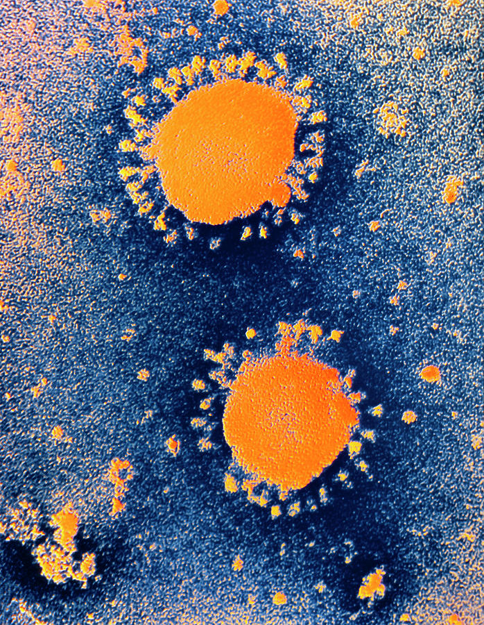 Biology Photograph - Coloured Tem Of Coronaviruses by Dr Steve Patterson/science Photo Library