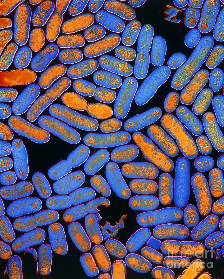 Coloured Tem Of Escherichia Coli Bacteria Photograph By E Gray Pixels