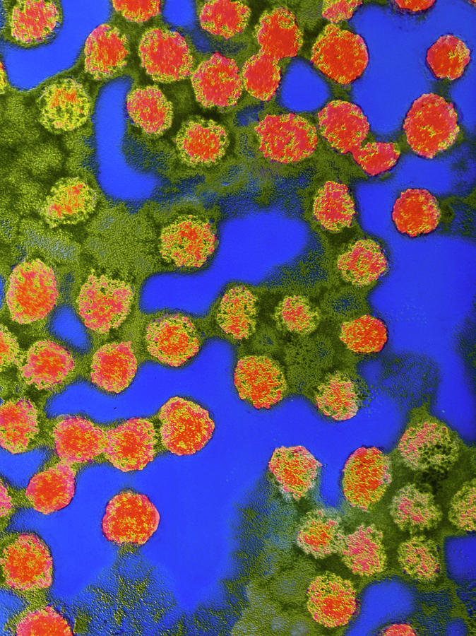 Coloured Tem Of Experimental Aids Vaccine Photograph by Nibsc/science Photo Library