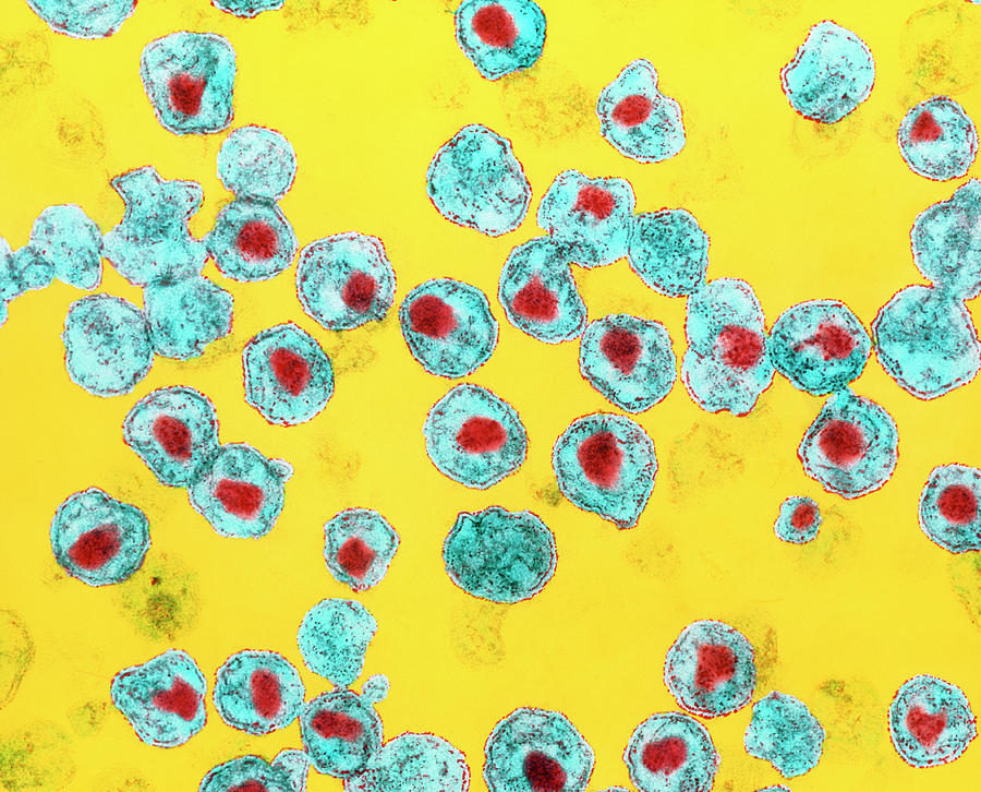 Coloured Tem Of Hiv-1 Viruses Photograph by Dr R. Dourmashkin/science Photo Library