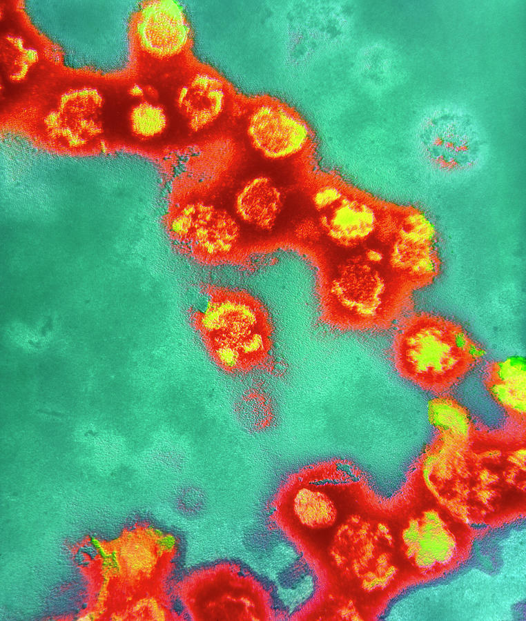 Coloured Tem Of Rubella Virus Particles Photograph by Nibsc/science Photo Library