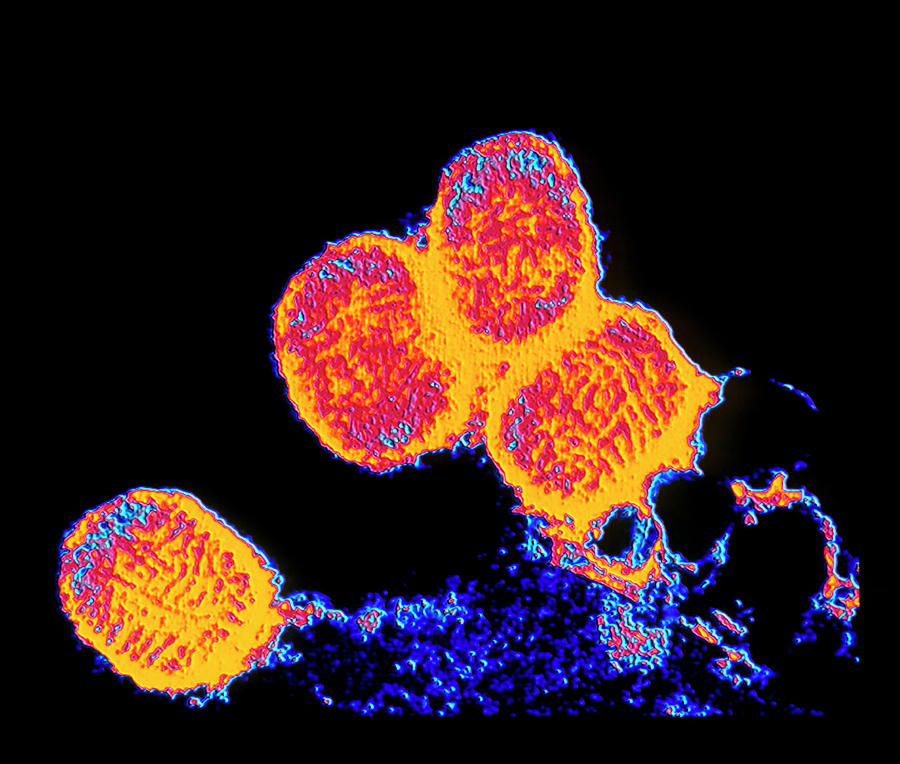 Coloured Tem Of Smallpox Variola Viruses Photograph by Alfred Pasieka ...