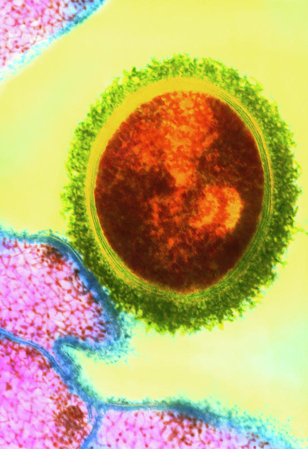 Coloured Tem Of Streptococcus Bacterium Photograph by Dr Immo Rantala/science Photo Library