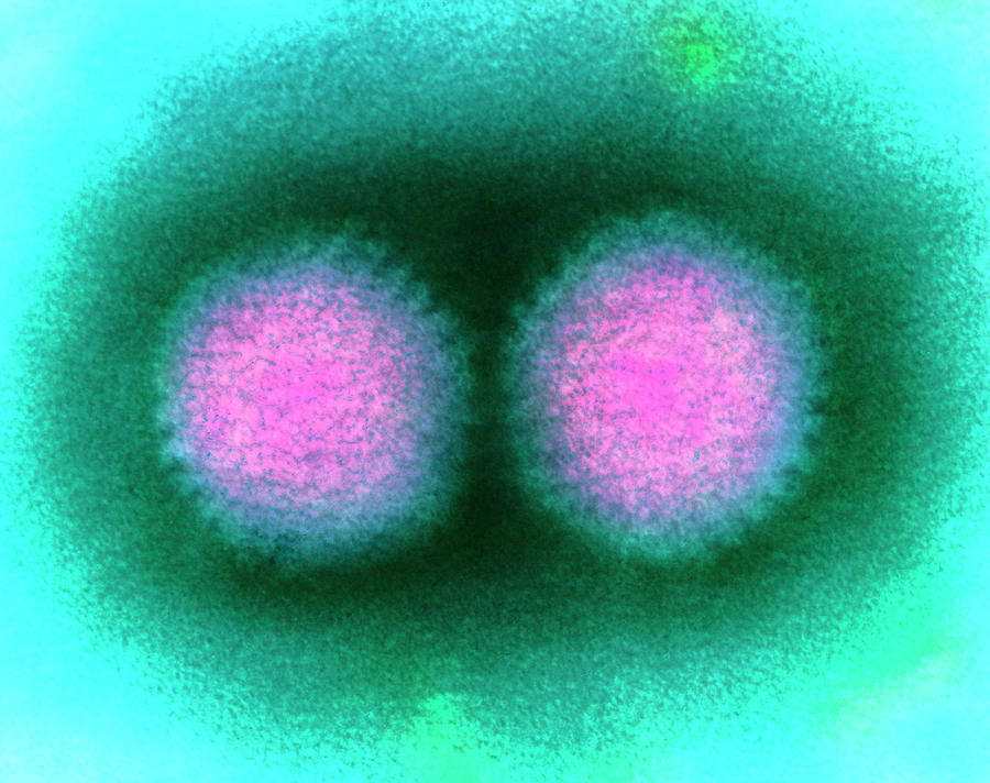 Coloured Tem Of Two Adenoviruses Photograph by Dr Kari Lounatmaa/science Photo Library