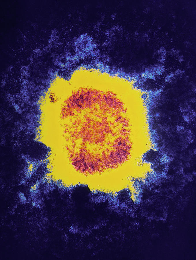 Coloured Tem Of Vaccinia Virus Particle Photograph by Dr Heather Davies/science Photo Library