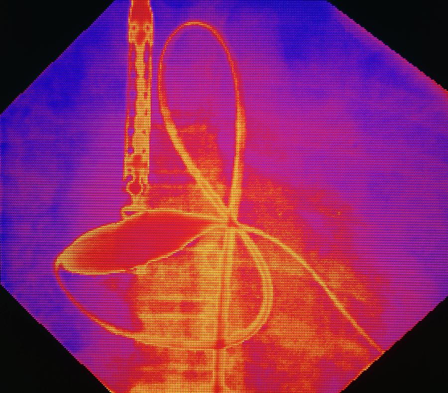 Coloured X-ray Of Cardiac Angioplasty In Progress Photograph by Mehau Kulyk/science Photo Library