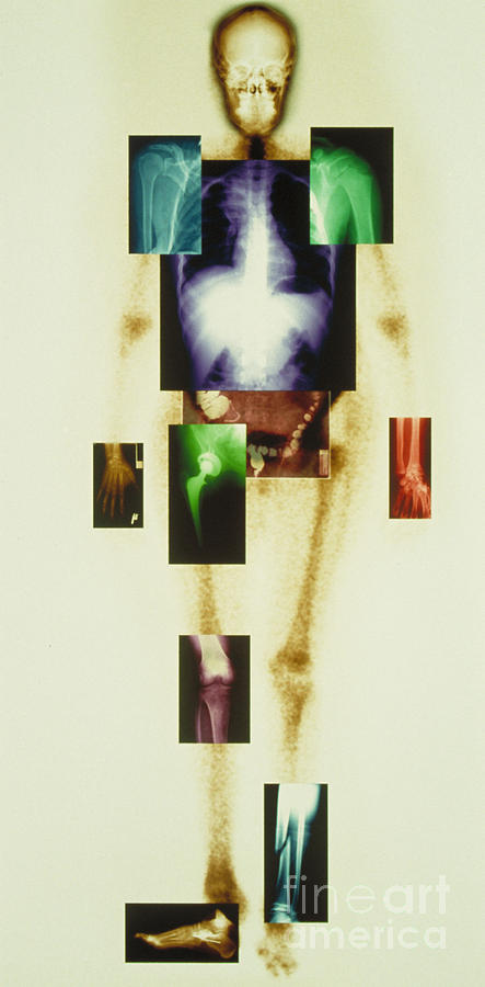 Composite Of Body Photograph By Scott Camazine Fine Art America